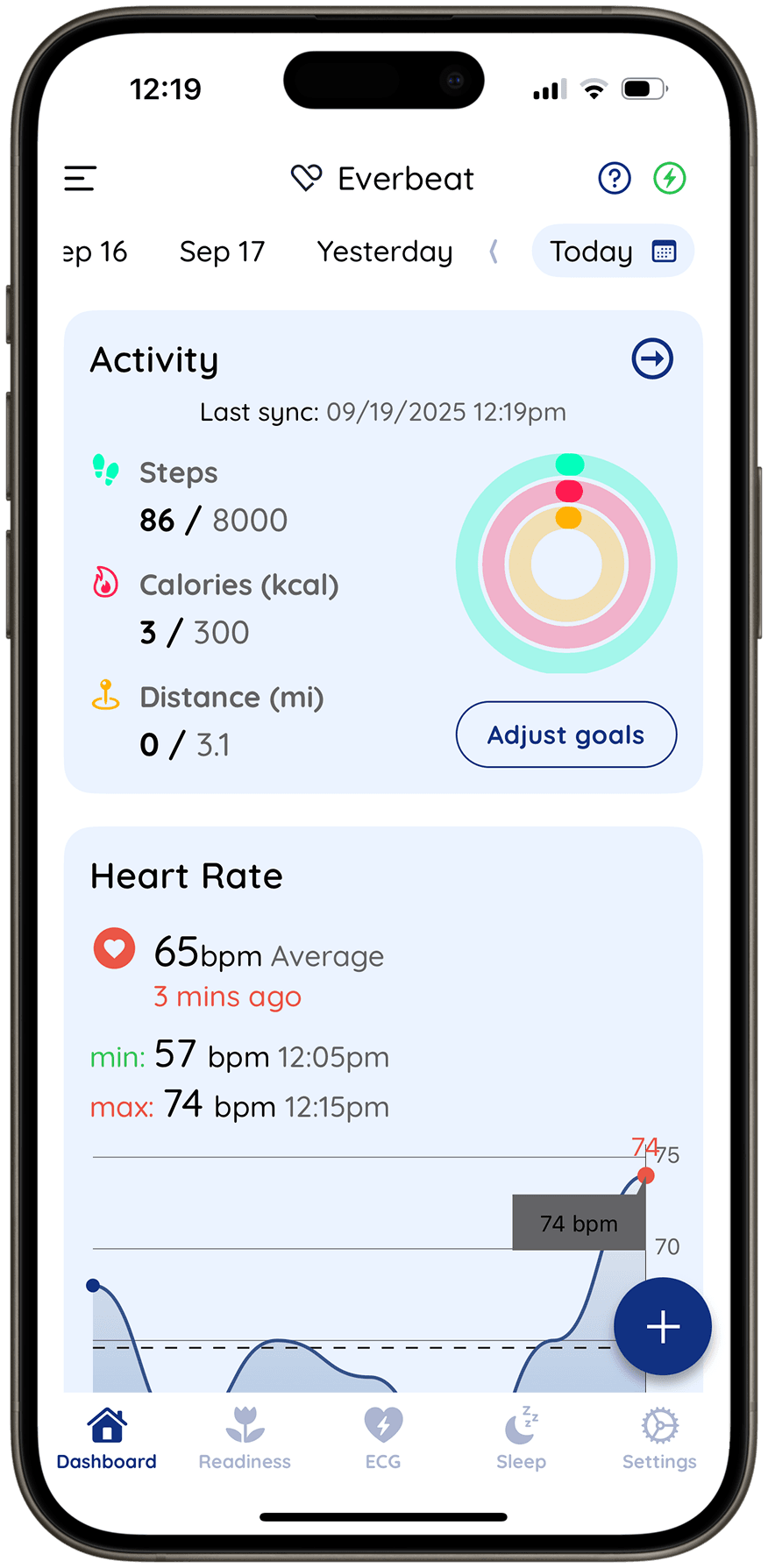 Cardiac Monitoring Platform for Wearable Health Technology-15